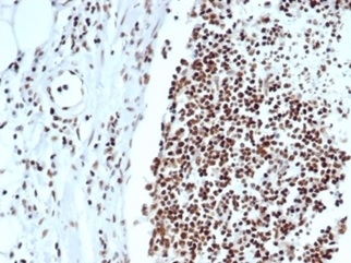 IHC staining of FFPE human lymph node with XRCC5 antibody (clone XRCC5/7318). HIER: boil tissue sections in pH 9 10mM Tris with 1mM EDTA for 20 min and allow to cool before testing.