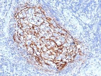 IHC staining of FFPE human tonsil tissue with CD35 antibody (clone CR1/6385) at 2ug/ml. HIER: boil tissue sections in pH 9 10mM Tris with 1mM EDTA for 20 min and allow to cool before testing. HIER: boil tissue sections in pH 9 10mM Tris with 1mM EDTA for 20 min and allow to cool before testing.