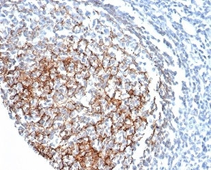 IHC staining of FFPE human tonsil tissue with CD35 antibody (clone CR1/6378) at 2ug/ml. HIER: boil tissue sections in pH 9 10mM Tris with 1mM EDTA for 20 min and allow to cool before testing.