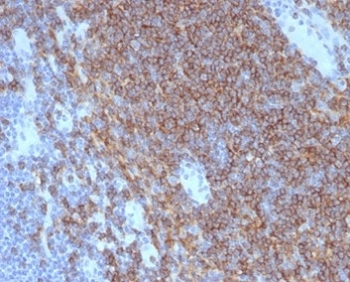 IHC staining of FFPE human lymph node with CD4 antibody (clone CD4/7142) at 2ug/ml in PBS for 30min RT. HIER: boil tissue sections in pH 9 10mM Tris with 1mM EDTA for 20 min and allow to cool before testing.
