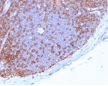 IHC staining of FFPE human lymph node tissue with CD4 antibody (clone CD4/7144) at 2ug/ml in PBS for 30min RT. HIER: boil tissue sections in pH 9 10mM Tris with 1mM EDTA for 20 min and allow to cool before testing.