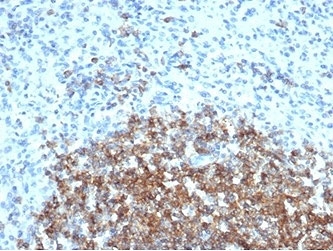 IHC staining of FFPE human spleen tissue with CD35 antibody (clone CR1/6377) at 2ug/ml. HIER: boil tissue sections in pH 9 10mM Tris with 1mM EDTA for 20 min and allow to cool before testing.