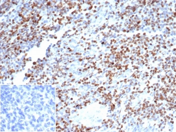 IHC staining of FFPE human tonsil tissue with recombinant POU2F2 antibody (clone OCT2/7073R). HIER: boil tissue sections in pH 9 10mM Tris with 1mM EDTA for 20 min and allow to cool before testing.